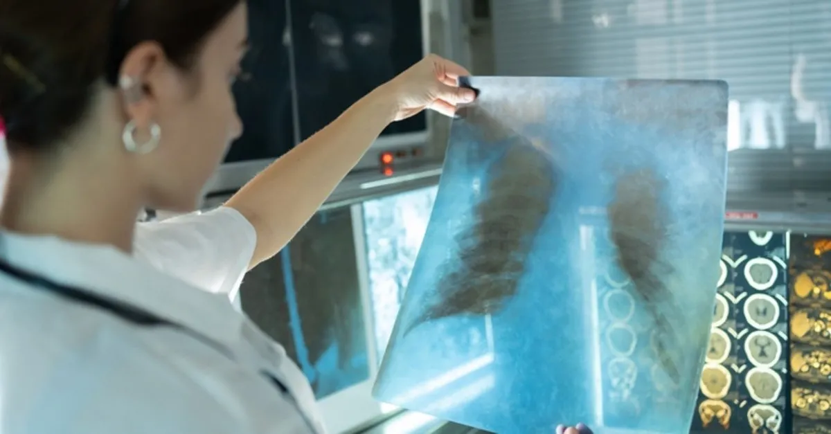 Hem kendini hem başkalarını hasta ediyorlar! Bu tedaviyi sakın yarım bırakmayın...