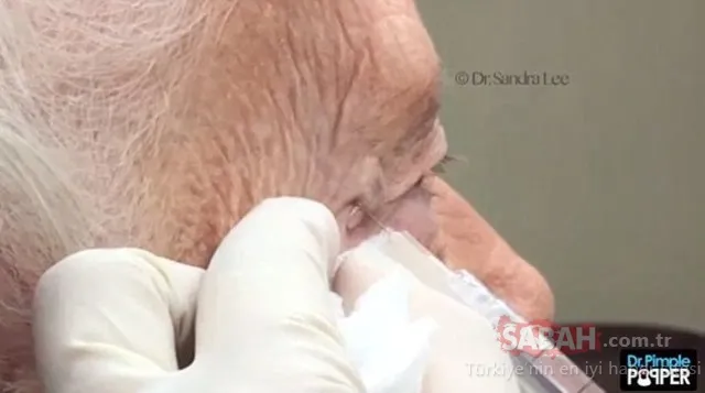 20 yıl bu şekilde yaşadı....Kafasından çıkanlar şoke etti!