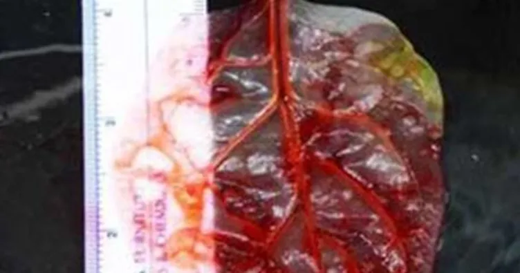 Ispanaktan kalp dokusu üretidi!