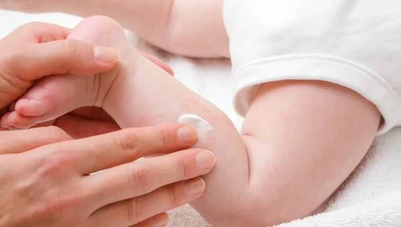 En hassas cilt: Bebeğinizin tenini en doğru şekilde nasıl korursunuz?