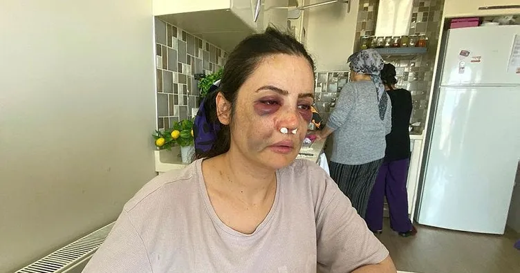 Silahı tutukluk yapınca darp etti