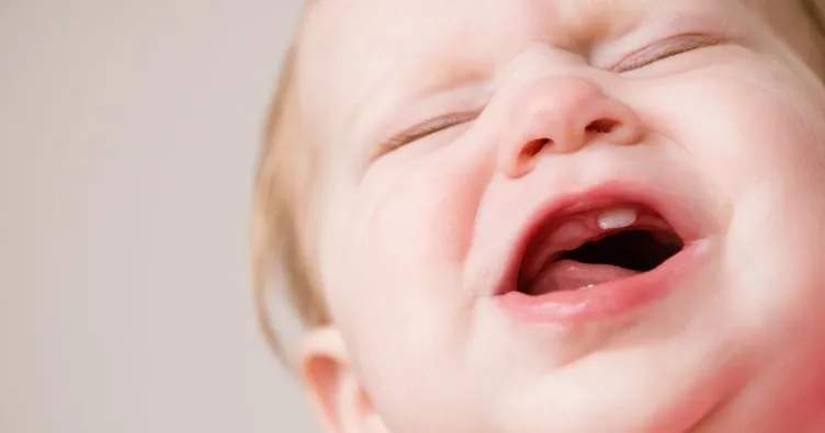 Bebeklerde diş çıkarmaya ne iyi gelir?