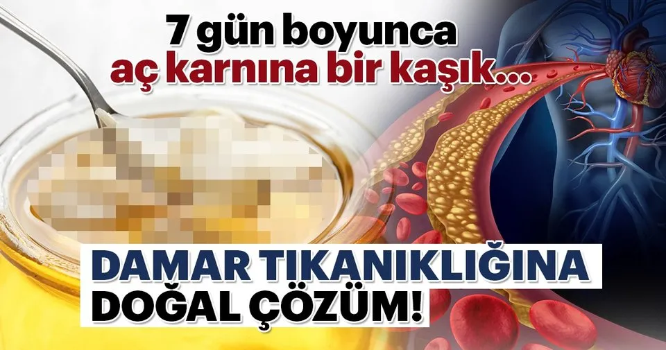 7 Gun Boyunca Ac Karnina Bir Kasik Damar Tikanikligina Dogal Cozum Sayfa 3 Kadin Haberleri
