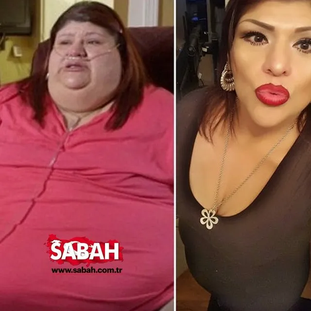 Ölümden döndü 223 kilo verdi! Azmin zaferi… Sayfa 3 Son Dakika