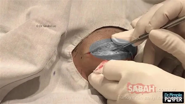 Doktora bu halde geldi! Sonrasındaysa...