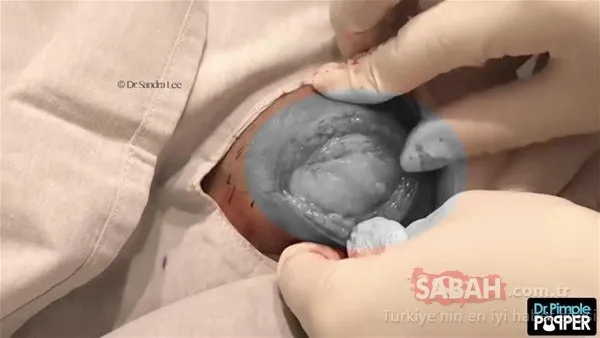 Doktora bu halde geldi! Sonrasındaysa...