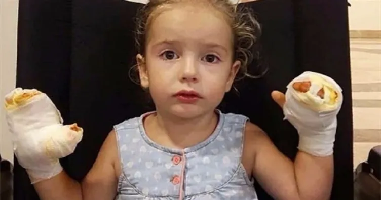 Uçan balon elinde patladı