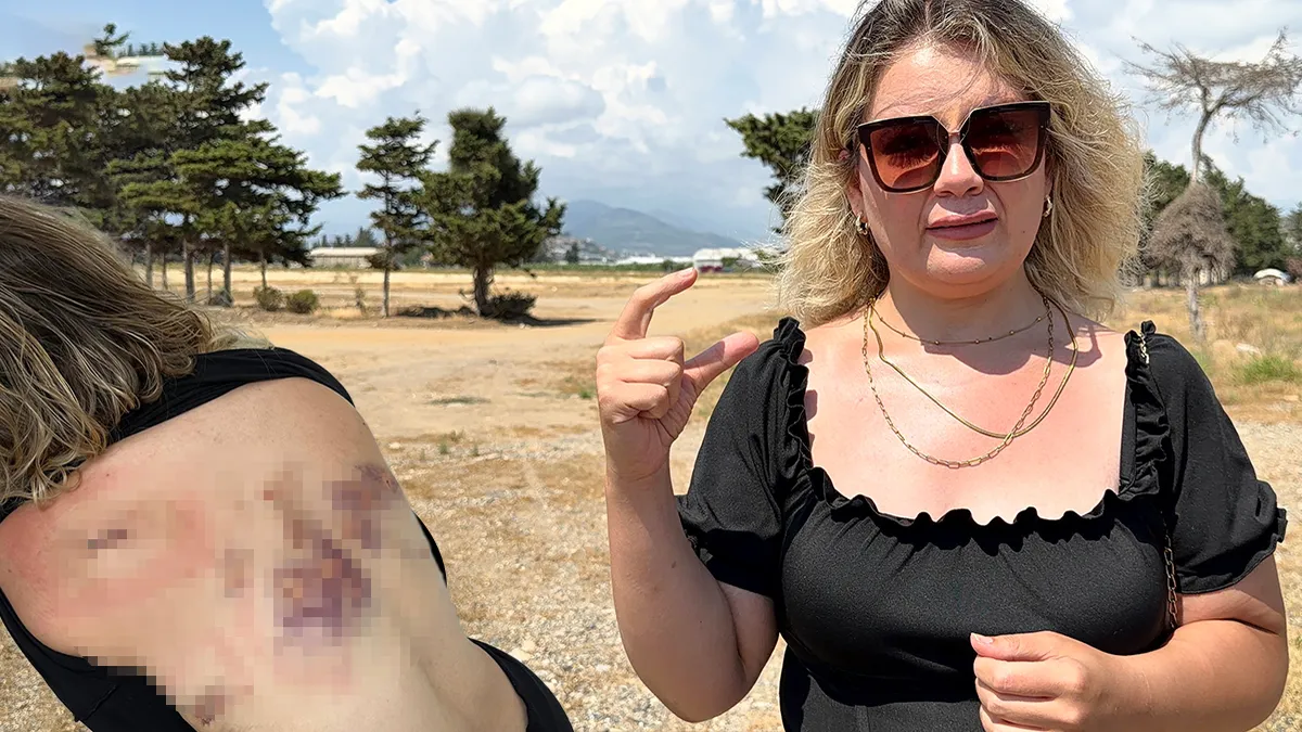 Eski sevgilisi tam 30 yerinden bıçakladı! Talihsiz kadın dehşeti anlattı: Bıçak sırtımda kırılmasa… Eski sevgilisi tam 30 yerinden bıçakladı! Talihsiz kadın dehşeti anlattı: Bıçak sırtımda kırılmasa…