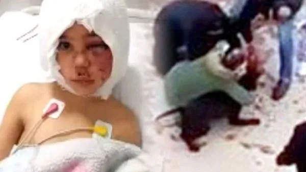 Son Dakika: Pitbull saldırısında ağır yaralanan Asiye Ateş'e doku nakli yapılmıştı: Bugün uyandırılacak | Video