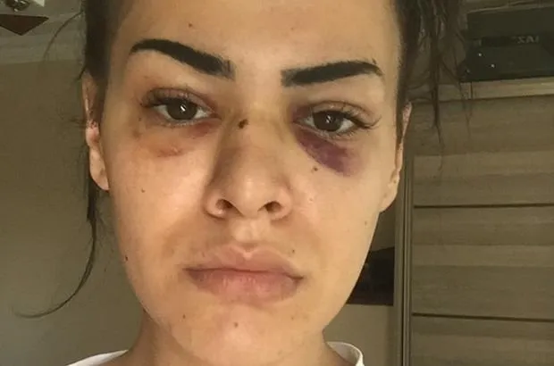 Son dakika haberi: İstanbul'un göbeğinde korkunç taciz iddiası! Nagehan Bıyıklı: “Korkudan evime gidemiyorum”