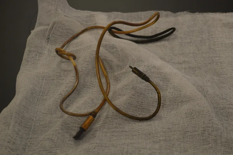 Kusma ve bulantı şikayeti ile hastaneye gitti: 15 yaşındaki çocuğun midesinden çıkanlar şaşkına çevirdi!