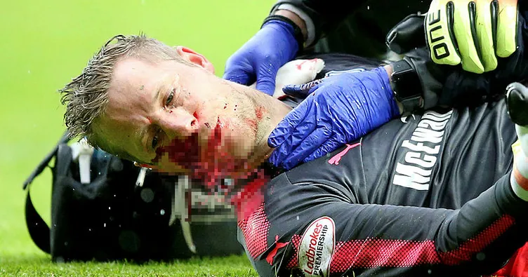 İskoçya’da yürekleri ağızlara getiren sakatlık!