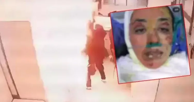 Adalet cezasını versin