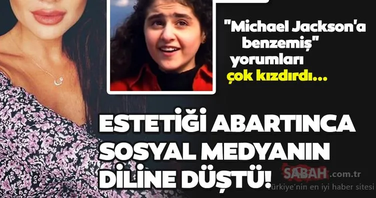 Azeri kızı Günel estetiği abartınca olanlar oldu! Michael Jackson’a benzemiş yorumları Günel Zeynalova’yı çok kızdırdı!