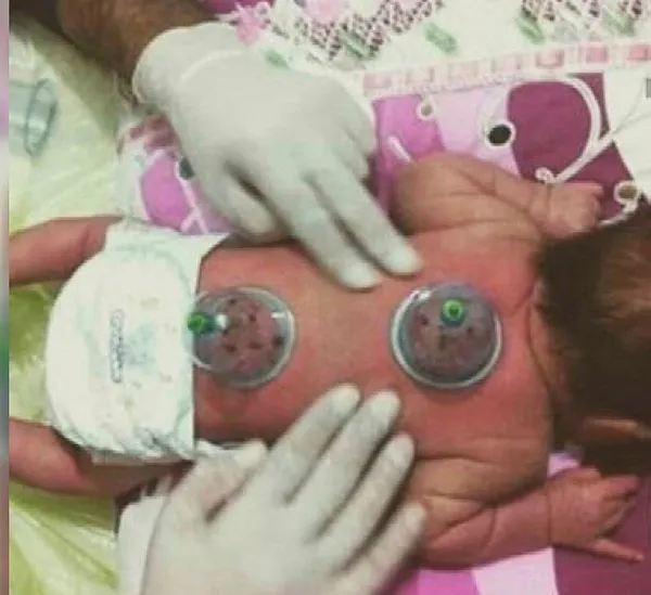 Koronavirüsten korur diyerek bebek ve çocuklara bunu Koronavirüsten korur diyerek bebek ve çocuklara bunu