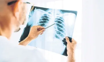 Akciğer dostu besinler