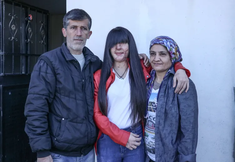 Yüzünü yakan kişiyle evlenen Berfin Özek herkesi şoke etti! Babası SABAH’a konuştu: Nasıl yapar bunu?