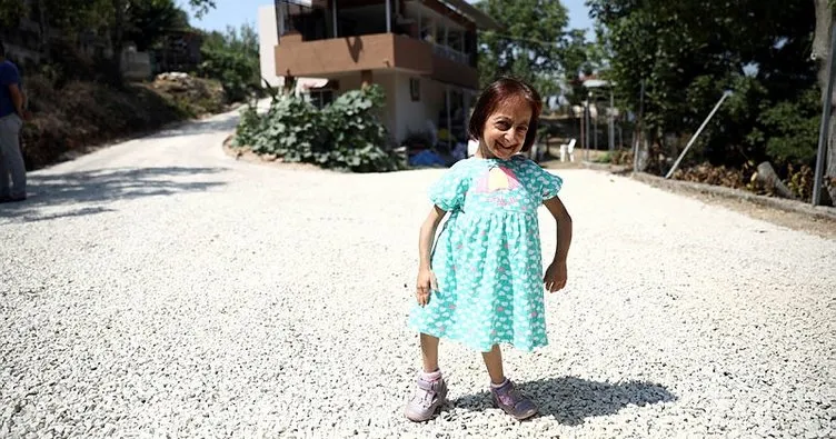 Türkiye’nin en kısa boylu kadınıydı! Zatürreden hayatını kaybetti