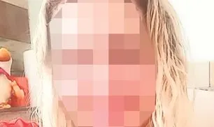 SON DAKİKA | Estetik ameliyatı genç kadının kabusu oldu: Kulağını kesip yüzünü diktiler