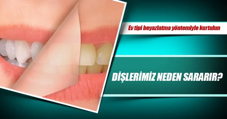 Dislerimiz Neden Sararir Sayfa 3 Saglik Haberleri