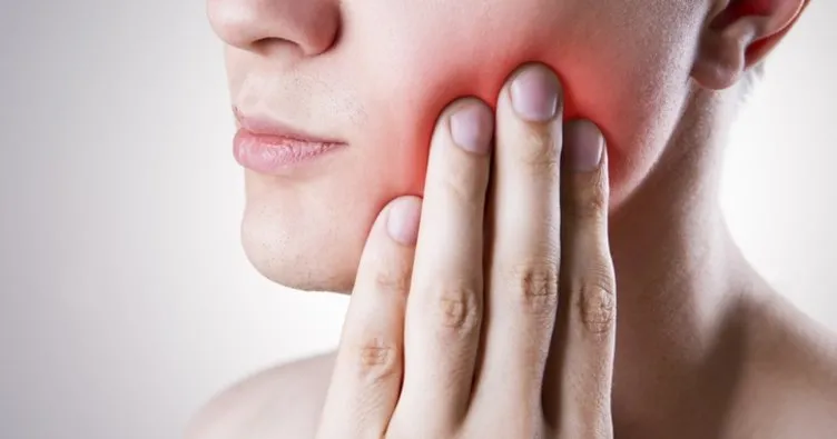 Diş apsesi nasıl geçer, bitkisel tedavi nasıl yapılır? Diş apsesine iyi