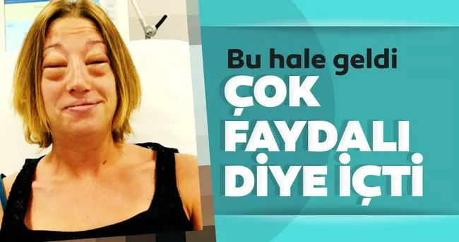 Son Dakika Haberi Esek Sutu Icti Az Kalsin Hayatini Kaybediyordu Faydali Bile Olsa En Son Haber