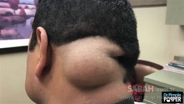 Doktora bu halde geldi! Sonrasındaysa...