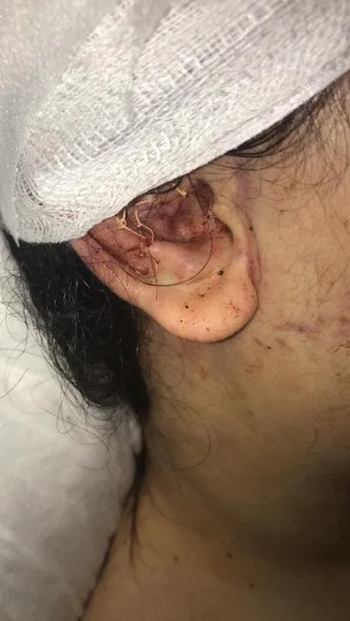 Son dakika haberi: Sultangazi’de talihsiz kadına tayt dayağı: Gözünü hastanede açtı