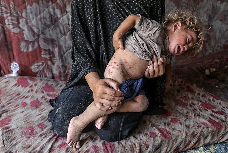 Son Dakika: ABD’li doktor Gazze’deki vahşeti bu sözlerle dünyaya duyurdu! Çocukları kasten kafalarından vuruyorlar