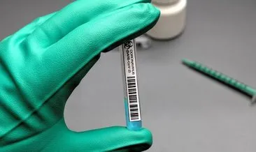 Fransa’da 9 bin yeni koronavirüs vakası