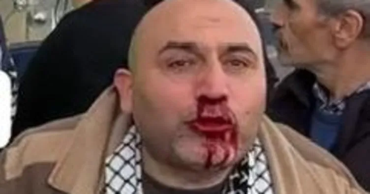 Filistin’e destek mitinginin dönüşünde saldırıya uğradı! Üniversiteli saldırgan tutuklandı