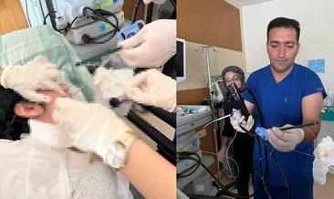 SON DAKİKA... Ağrı'da akılalmaz olay! Doktorlar bile şaştı kaldı: Midesinden biri kurşun, biri tükenmez kalem çıktı! #agri
