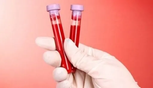 Son dakika: Kan grubu ’A’ olanlar için korkutan koronavirüs uyarısı! Uzman isimden flaş açıklama...