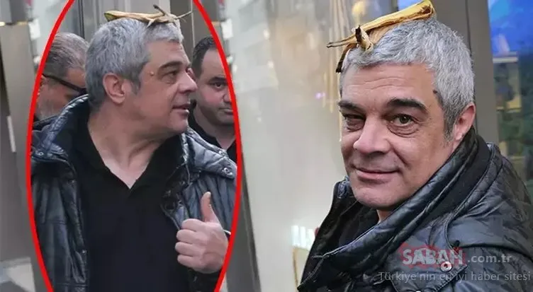 Bir dönemin en yakışıklı oyuncusuydu! Şimdi kafasında muz kabuğuyla sokaklarda dolaşıyor! 48 yaşındaki Murat Prosçiler’in son hali inanılır gibi değil