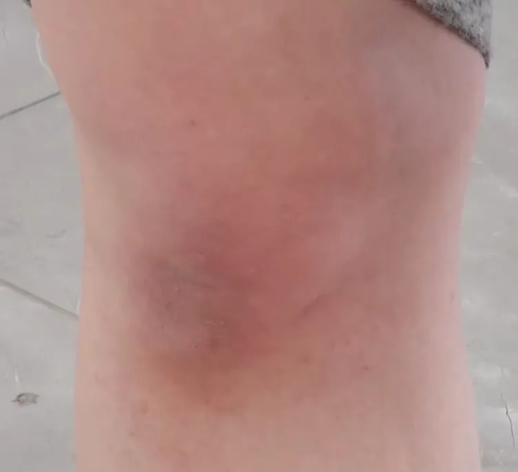 Ankara’da dehşet gecesi: Tarlaya götürüp boğazımı sıktılar tecavüz ettiler! O anları anlattı...