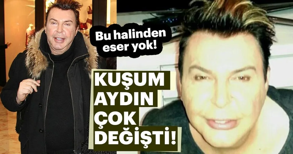kusum aydin ameliyatla degil sporla son dakika magazin haberleri