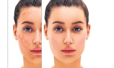 İzleri görünmez kılabilir miyiz?