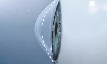 Sık sık gözünü ovuşturanlar dikkat!