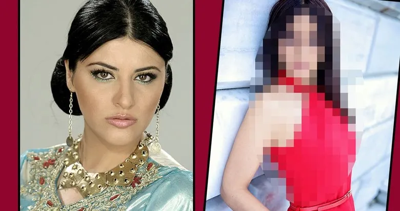 Estetiksiz Hali Soke Etti Galeri Magazin