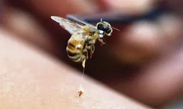 Arı sokmasına ne iyi gelir, ne yapılır? Arı sokması şişliği ne kadar zamanda iner, şişlik ve kaşıntı nasıl geçer?