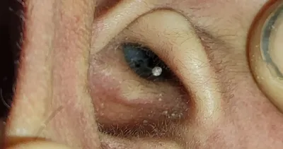 Akılalmaz düzenek! Ehliyet sınavında 10 bin TL’lik kopya düzeneği ile yakalandı