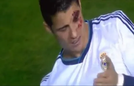 Ronaldo kanlar içinde kaldı