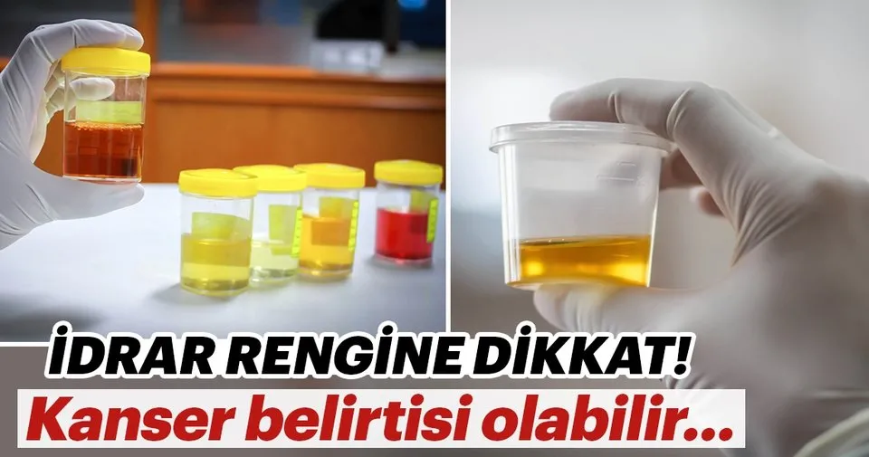 idrar renginiz ne anlama geliyor