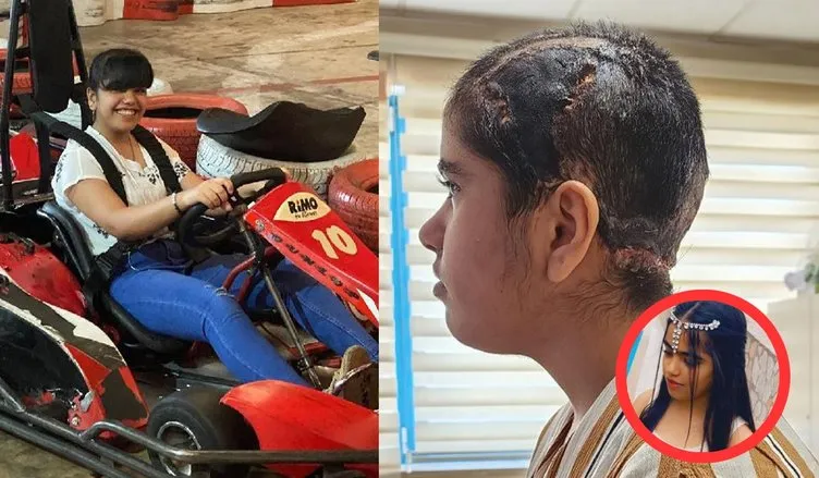 Go-kart aracına saçını kaptırdı: Derisi başından sıyrıldı!