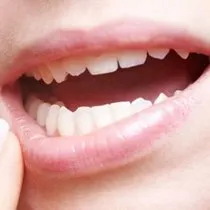 dis eti agrisina ne iyi gelir dis eti