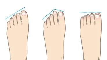 Ayak şekliniz kişiliğinizi ele veriyor! Doğuştan “lider” olan o kişiler…