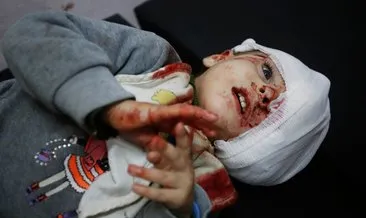 İsrail’in vurduğu hastanede bebekler ölüm kalım savaşı veriyor!