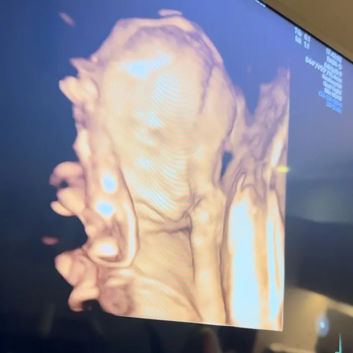 Cansel Elçin ve Zeynep Tuğçe Bayat’tan yürek ısıtan paylaşım! Atlas bebek büyükanneleriyle böyle tanıştı