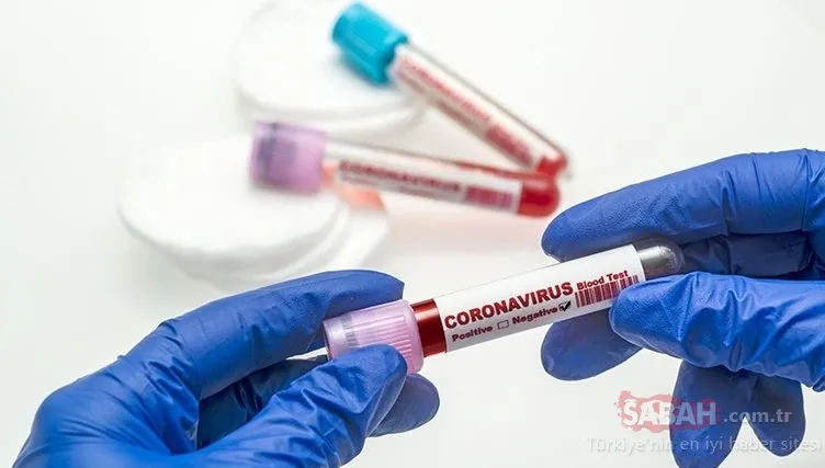 Son dakika haberi: Corona virüs nasıl bulaşıyor? Coronavirüs belirtileri neler? İşte gün gün Covid 19 takvimi…