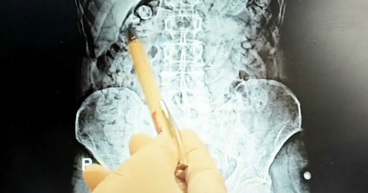 Uyuşturucuyu midelerinde saklamışlar